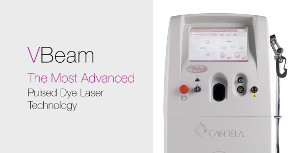 Vbeam de CANDELA, laser à colorant pulsé